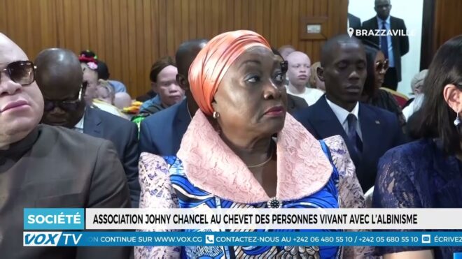 association-johny-chancel-au-chevet-des-personnes-vivant-avec-l’albinisme-–-vox-congo